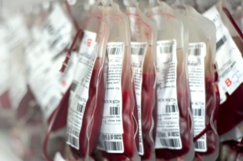 Sangue, scorte ridotte dopo l’estate: appello ai donatori dall’ospedale di Lamezia